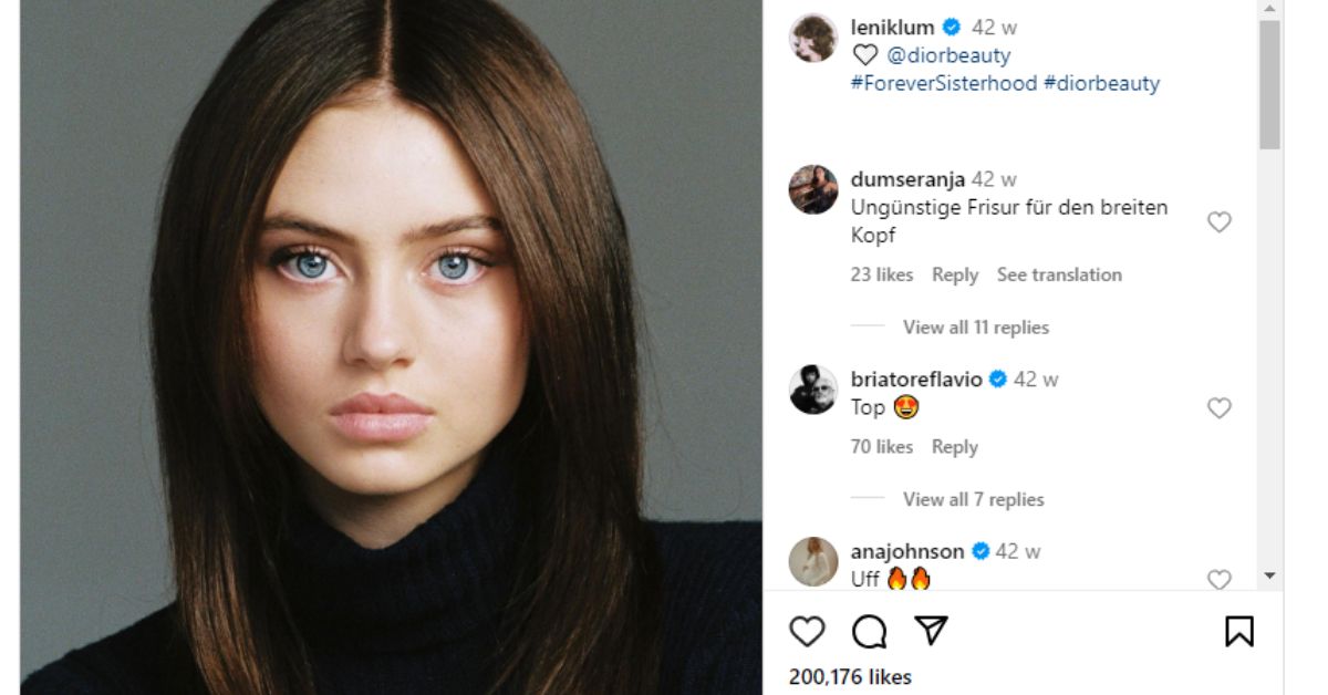 Leni Klum Plastic Surgery 